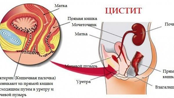 Окситоцин, вводимый в мышцу или в вену для снижения кровопотери после вагинальных родов