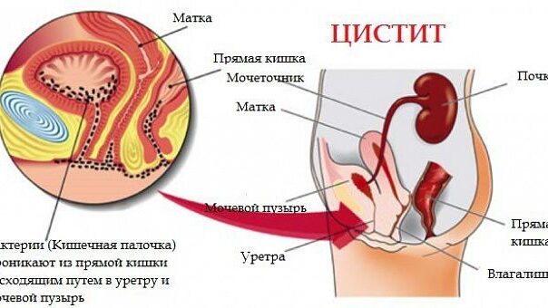 Гельминты и кожные проявления