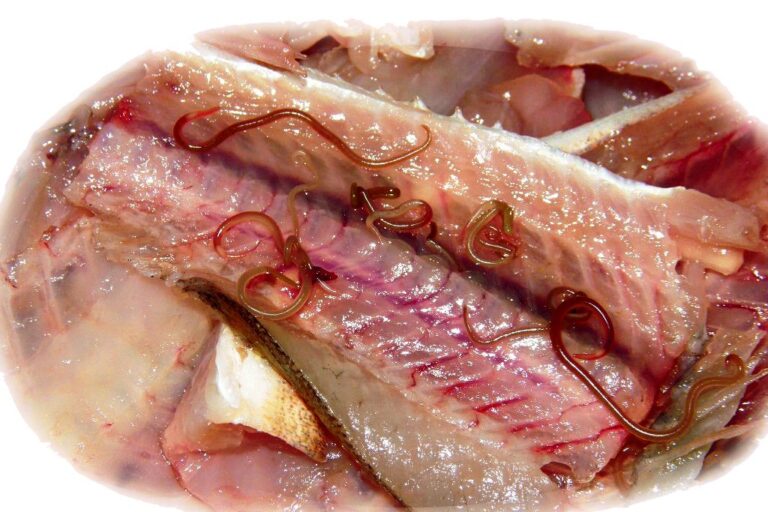 opistorhoz описторхоз