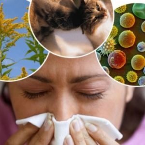 аллергия лечение