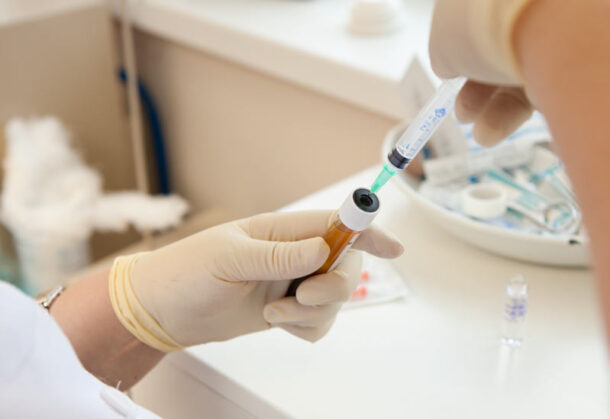 plasmolift_systavov plasmolift_systavov