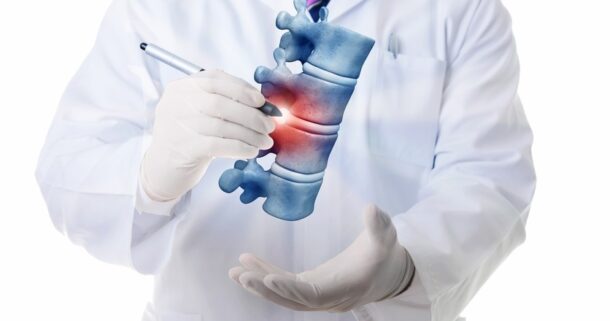 Грыжа-Шморля