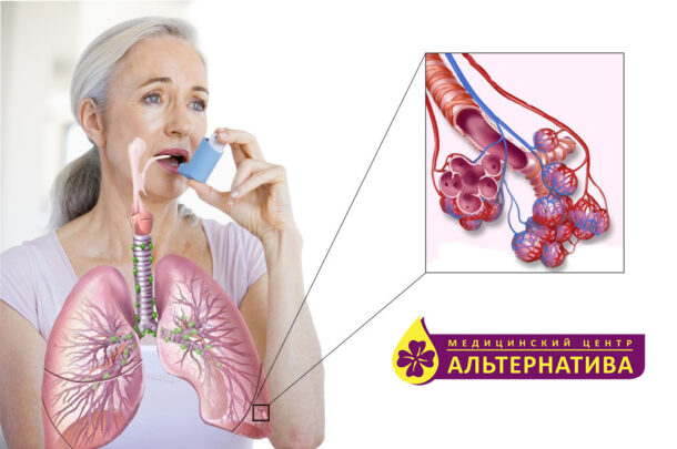 астма астматические приступы