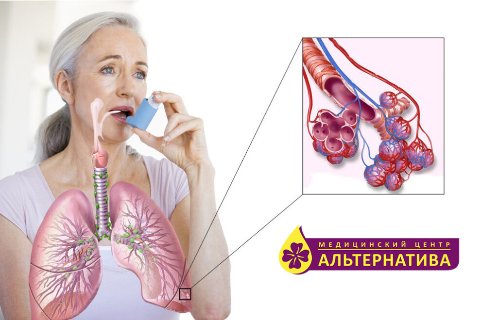 астматические приступы