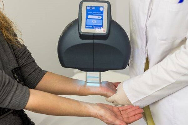 лечение витилиго лазером