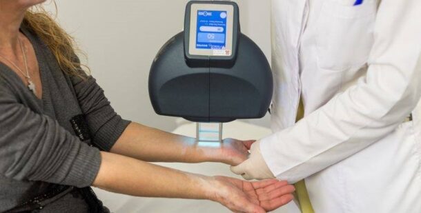 лечение витилиго лазером лечение витилиго лазером