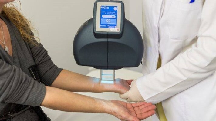 лечение витилиго лазером