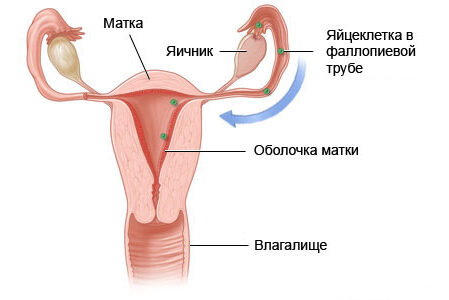 amenoria аменорея