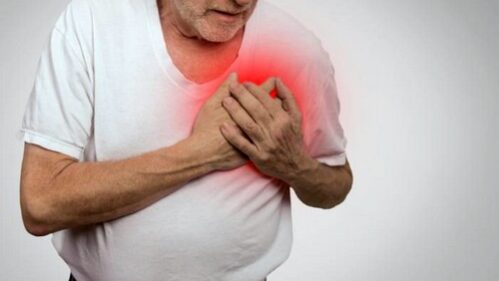 mercatelnaiy-aritmya мерцательная-аритмия