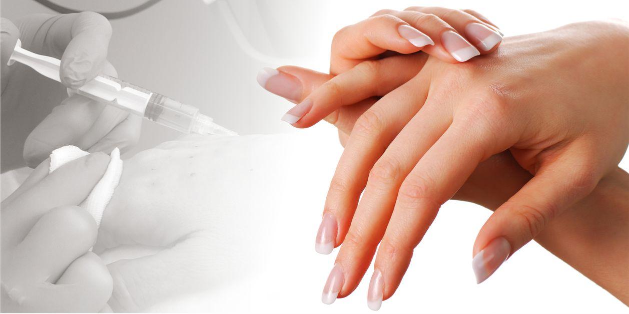 плазмолифтинг-кистей-рук