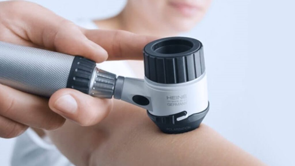 дерматоскопия