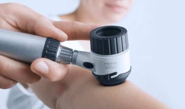 dermatoskopia дерматоскопия