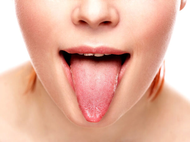 glossit глоссит