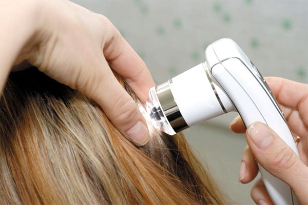 trihoskopia1 трихоскопия