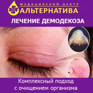 Демодекс