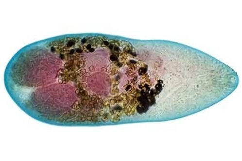 metagonizm метагонизм