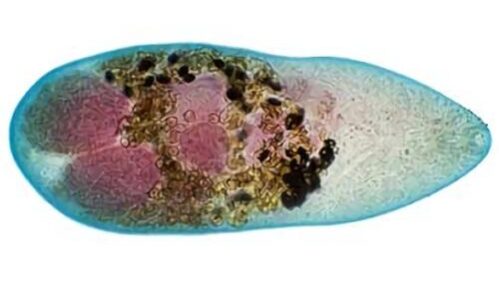 metagonizm метагонизм