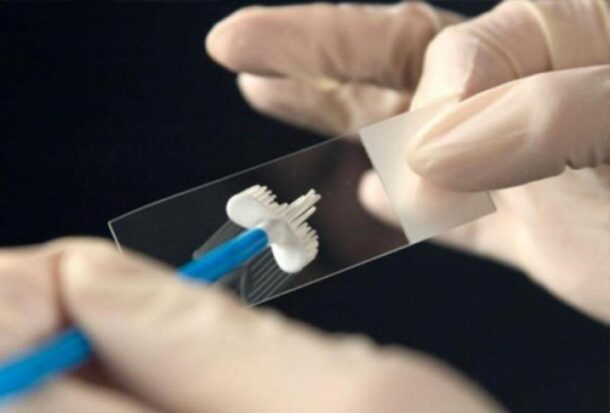 PAP test ПАП тест