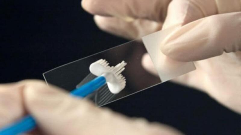 PAP test ПАП тест