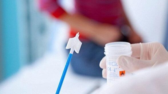 pap_test-zhidkostnaya-citologiya пап-тест-жидкостная-цитология