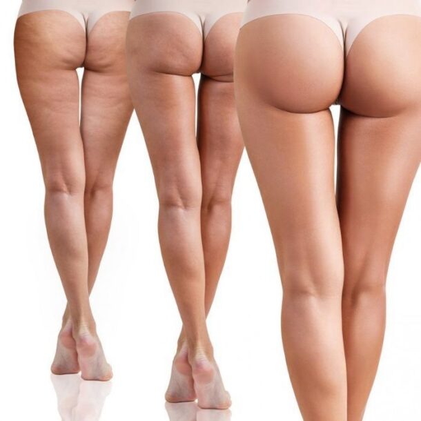 massazh—korrekciya-figury массаж-коррекции-фигуры