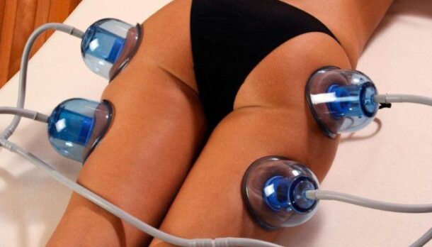 vakuumniy-massage-beder вакуумный массаж бедер