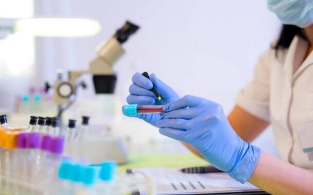 анализ крови на аллергию анализ крови на аллергию