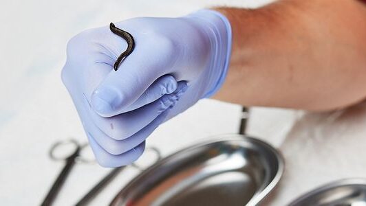 пиявки при гипертонии гирудотерапия при гипертонии