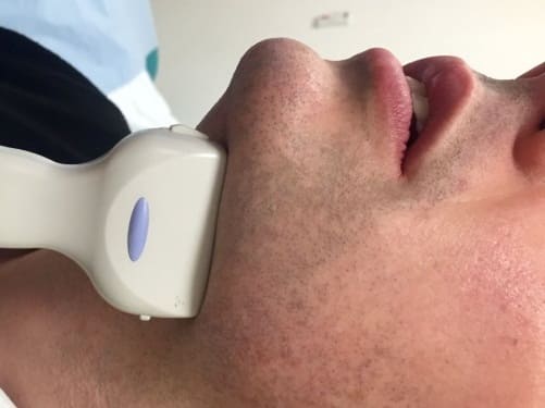 УЗИ слюнных желез УЗИ слюнных желез