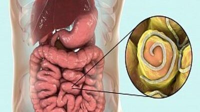 Дифиллоботриоз