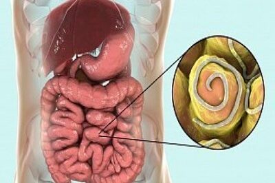 Дифиллоботриоз