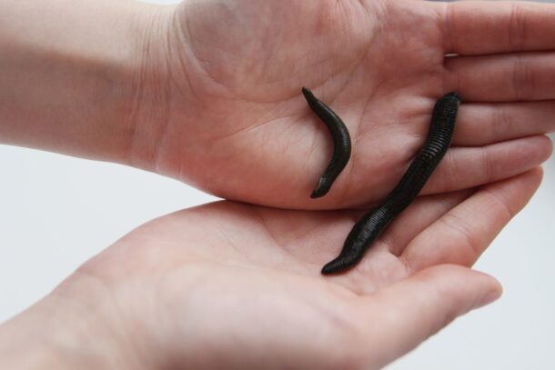 гирудотерапия при подагре