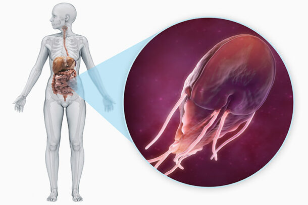 лечение лямблиоза лечение лямблиоза