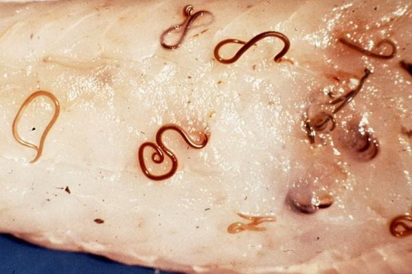 протозойные инфекции протозойные инфекции