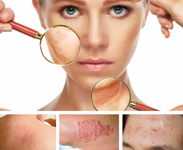 заболеванияна коже заболевания на коже