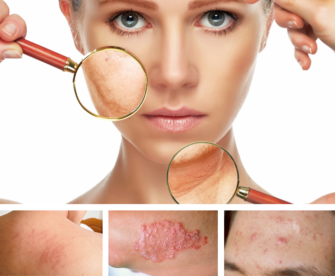 заболеванияна коже заболевания на коже