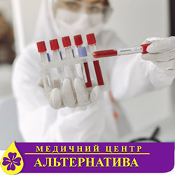 Гамма-глутамилтранспептидаза (GGT)